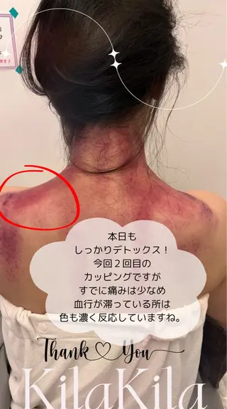 ドライヘッドスパ KilaKilaのエステ・リラクイメージ