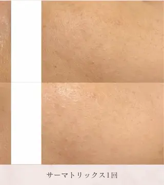 看護師が施術する美容 ナスサロshokoのエステ・リラクイメージ