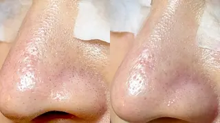 Lipula リプラ所属・毛穴ツヤ肌専門    Lipulaのエステ・リラクイメージ