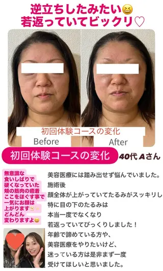 la lumie're (ラ リュミエール)所属・小顔サロン (ラ リュミエール)のエステ・リラクイメージ