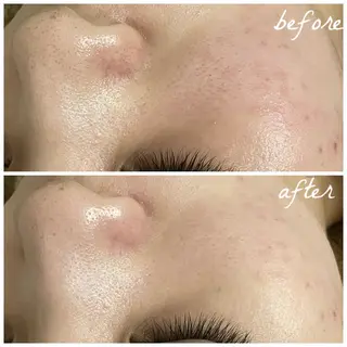 メンズ メナード岐阜市茜部 杉浦のエステ・リラクイメージ