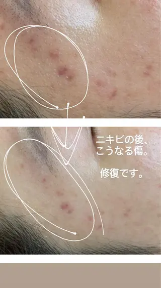 セミロング カラー パーマ ヘアアレンジ メンズ キッズ ネイル 金の糸脱毛 産毛ケア専門のエステ・リラクイメージ