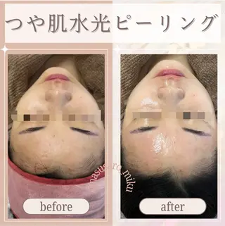 🎀韓国式肌改善🎀 Miku🇰🇷💎のエステ・リラクイメージ