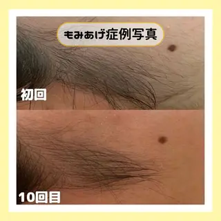 金山/脱毛/美肌 ULULUのエステ・リラクイメージ