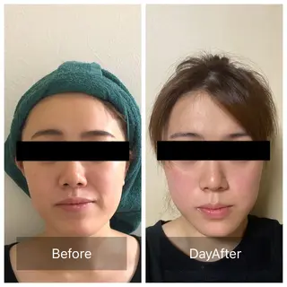 Radiance H.Oのエステ・リラクイメージ