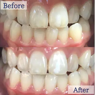 LBSホワイトニング 新宿店💎店長のエステ・リラクイメージ