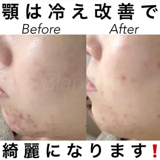ショート カラー パーマ ヘアアレンジ ネイル マツエク・マツパ 都度払い肌質改善 &脱毛Blancheのエステ・リラクイメージ