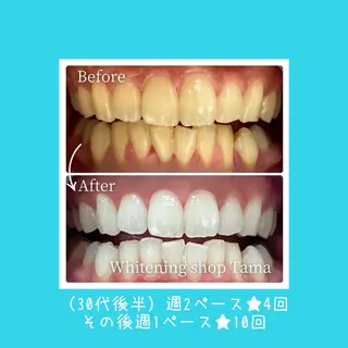 ホワイトニング ショップ多摩店のその他イメージ