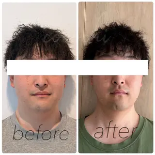 小顔と ヘッドスパのお店のエステ・リラクイメージ