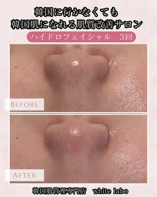 ホワイトラボ梅田 ｜毛穴・韓国肌管理のエステ・リラクイメージ