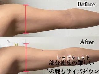 六本木脱毛andS さおりのエステ・リラクイメージ