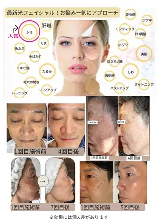 希映 -kieのエステ・リラクイメージ