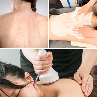 毛穴洗浄特化🫧 オオツカのエステ・リラクイメージ