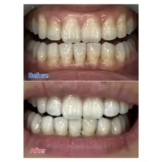 M渋谷 ホワイトニングのエステ・リラクイメージ