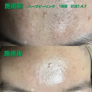 La.pport ラポールのエステ・リラクイメージ