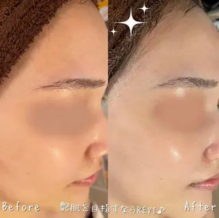 NA skin たまプラーザ　川島のエステ・リラクイメージ