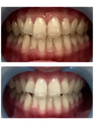 脱毛&フェイシャル BiSTA〈ビスタ〉のエステ・リラクイメージ