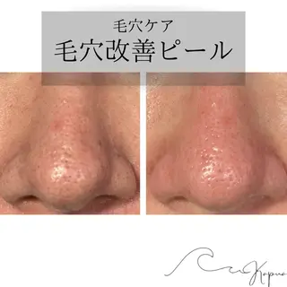 Kapua🌺 マユのマツエク・マツパデザイン