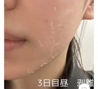 レイビス 渋谷店波間❤️のエステ・リラクイメージ