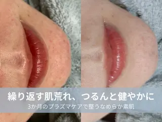 La chic.のエステ・リラクイメージ