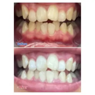 Ｍ渋谷 ホワイトニングのエステ・リラクイメージ