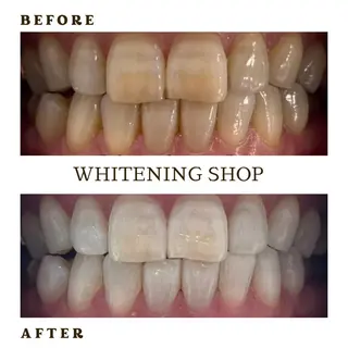 メンズ ホワイトニング ショップ葛西店のその他イメージ