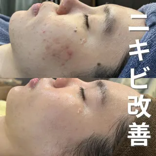 leolo武蔵浦和 肌質改善&脱毛のエステ・リラクイメージ