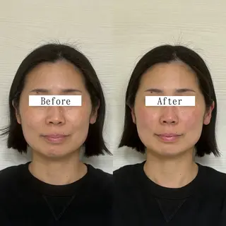 Stellum 小顔矯正&ヘッドスパのエステ・リラクイメージ