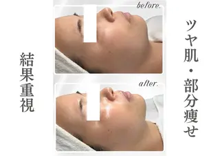 LiAm《美肌管理/ 小顔/脂肪ケア》のその他イメージ