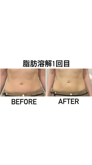 アルカンジュ~archange~所属・痩身/毛穴洗浄/脱毛 アルカンジュのエステ・リラクイメージ