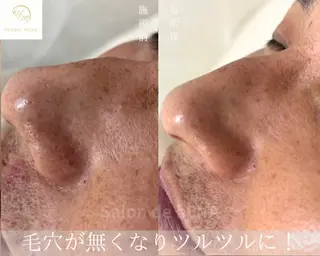 ハーブピーリング専門 サロンドレナ平岡のエステ・リラクイメージ