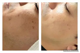 ビューティーサロン B.glossyのネイルデザイン