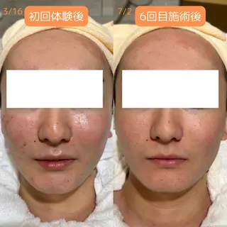 メンズ pansy フェイシャルエステのエステ・リラクイメージ