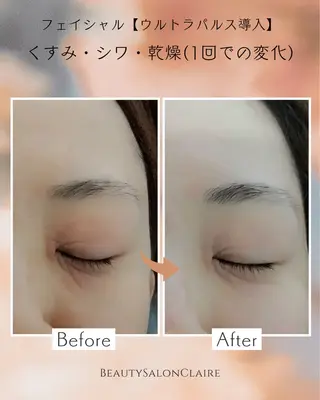 口コミ★5獲得 Claire鈴木のエステ・リラクイメージ