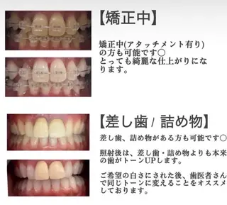 ホワイトニング ショップ伊丹店のその他イメージ