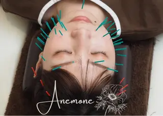美容鍼・整体サロン アネモネ🌸心斎橋のエステ・リラクイメージ