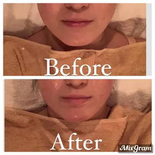 ワックス脱毛 ♡AYO♡のエステ・リラクイメージ