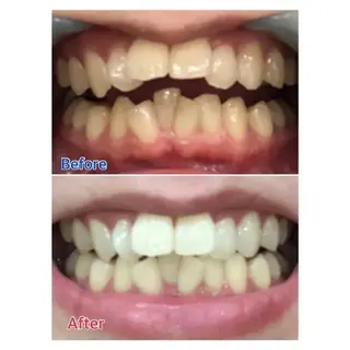 M渋谷 ホワイトニングのエステ・リラクイメージ