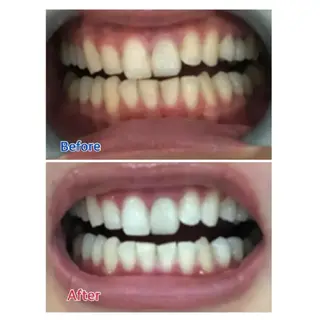 M渋谷 ホワイトニングのエステ・リラクイメージ