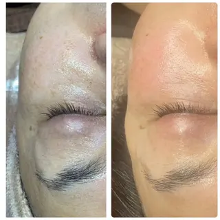 💫Linola💫 レイビス　小林のエステ・リラクイメージ