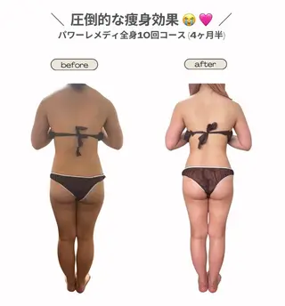 《本気痩せ×疲労改善 》  BILOOPのエステ・リラクイメージ