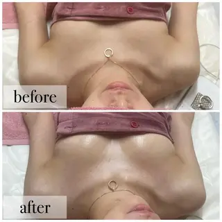 Ellaバストアップ &肌質改善🍃専門店のエステ・リラクイメージ