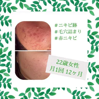 ミディアム カラー パーマ ヘアアレンジ メンズ キッズ ネイル マツエク・マツパ ニキビ・肌質改善専門 ♡人生が変わるサロンのエステ・リラクイメージ