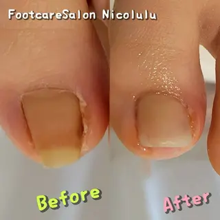 メンズ 足トラブル専門 ニコルル金沢のエステ・リラクイメージ