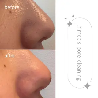 艶肌ハーブピーリング /毛穴洗浄のエステ・リラクイメージ