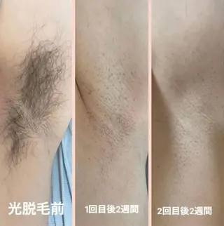 キッズ 別府脱毛サロン Grandeのエステ・リラクイメージ