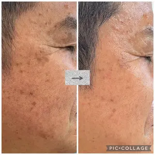 トータルビューティーサロン LilyRose所属・エステサロン LilyRoseのエステ・リラクイメージ