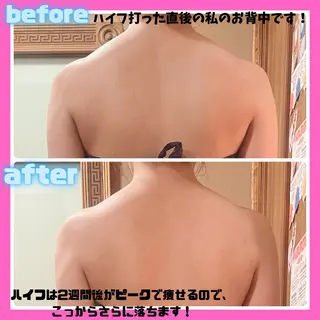 痩身&美肌サロン 堀米✨のその他イメージ