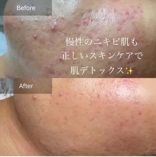 CHIO🌷心斎橋 毛穴・艶肌専門店のエステ・リラクイメージ