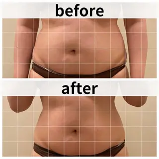 美容鍼/ヘッドスパ/ 💎さかもとのエステ・リラクイメージ